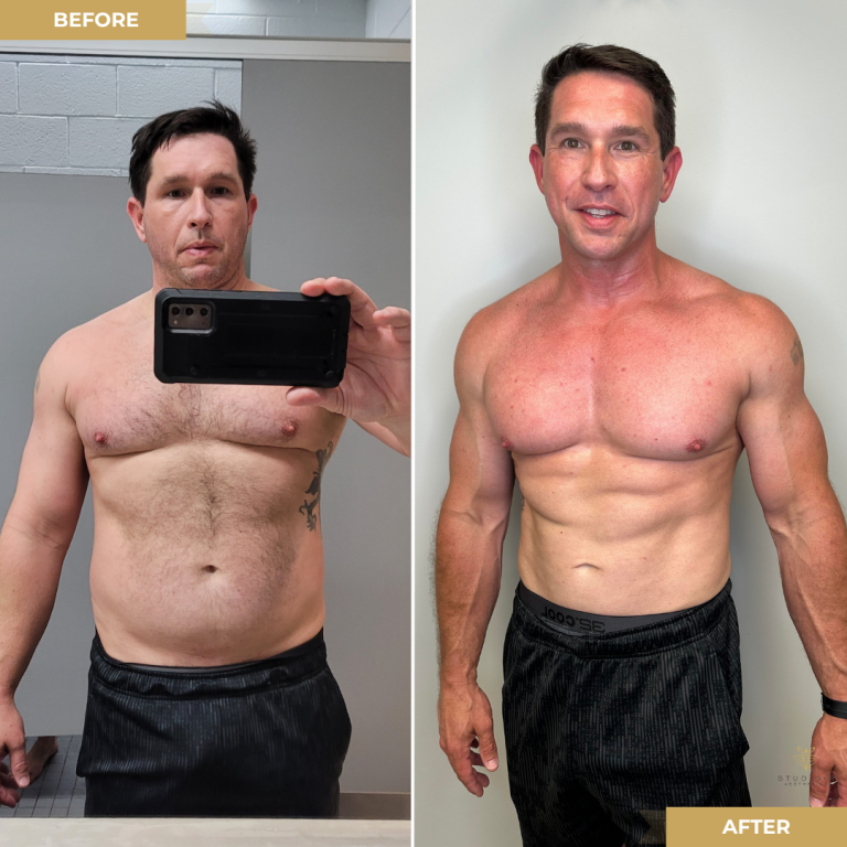 Body transformation before and after comparison.