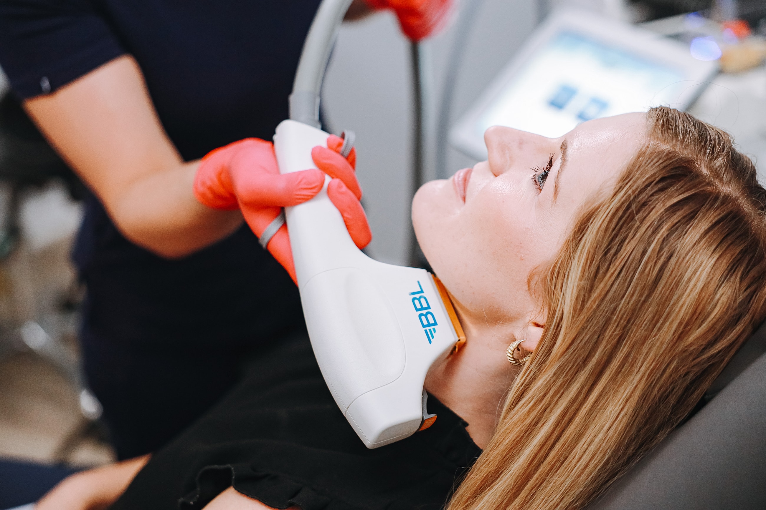 Woman receiving BBL laser treatment at a medical spa