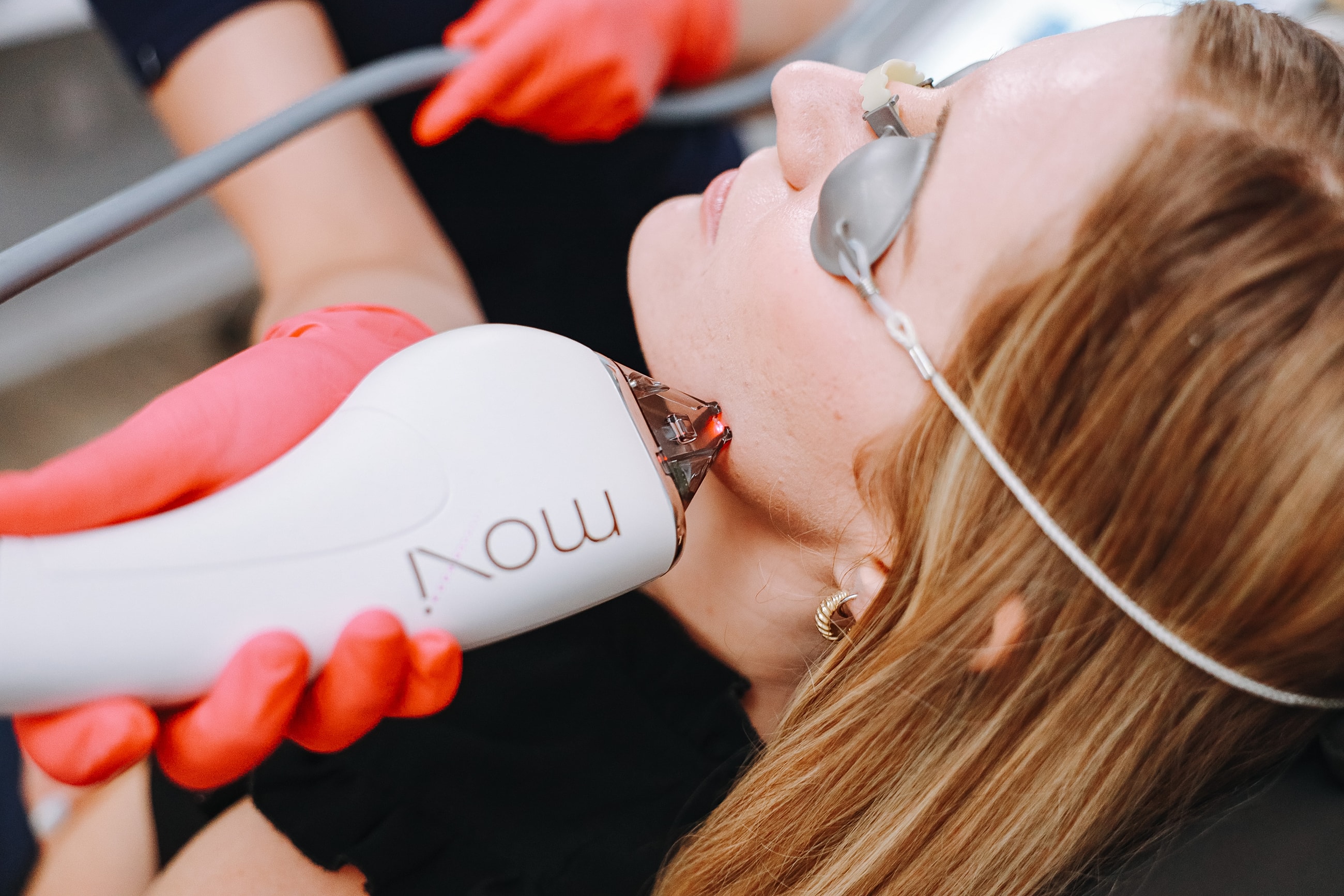 Laser treatment session at a skincare clinic.